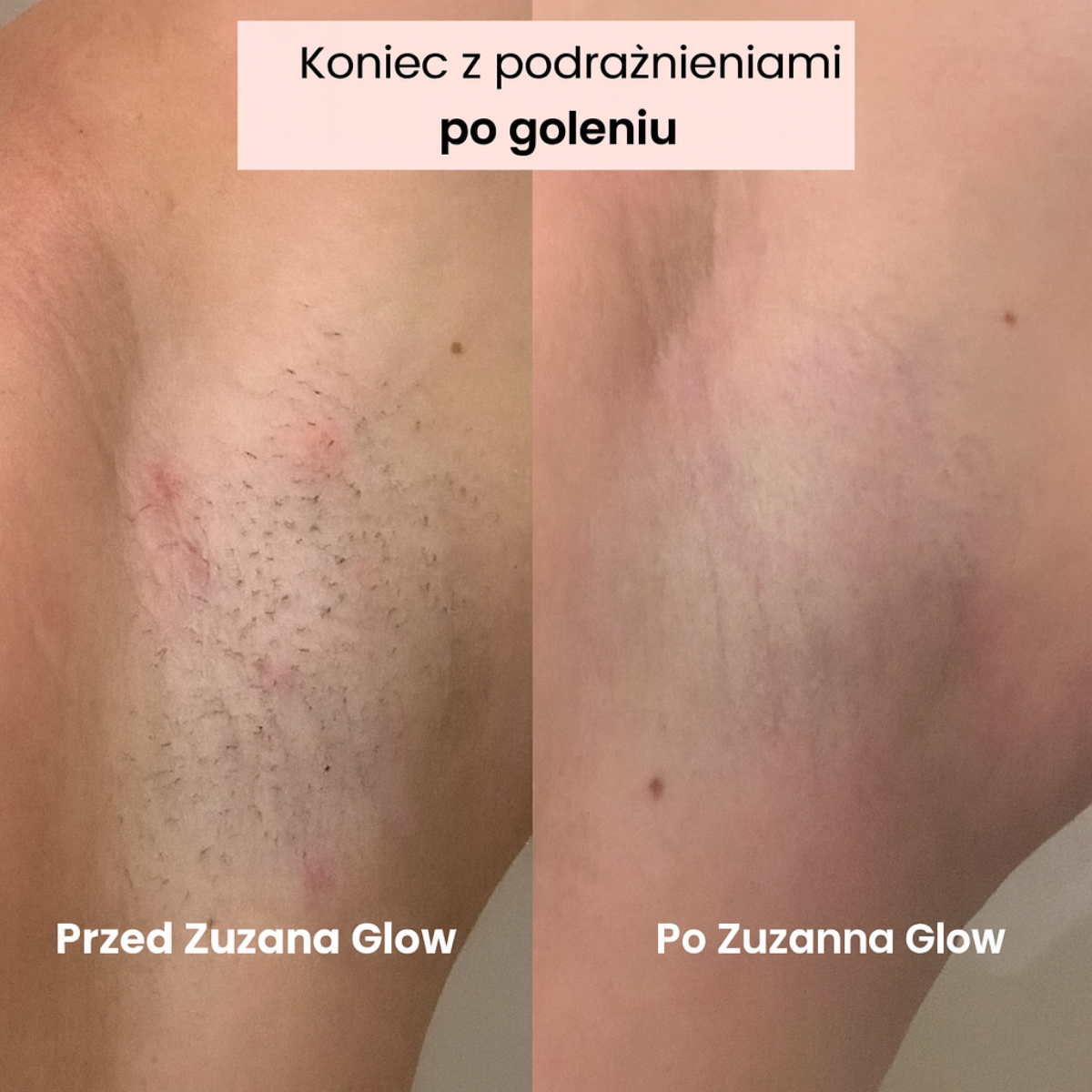 Zuzanna Glow Trymer 2w1