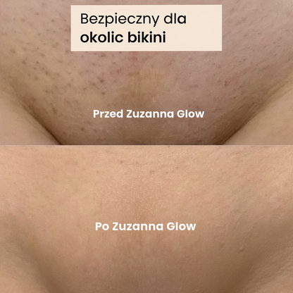 Zuzanna Glow Trymer 2w1