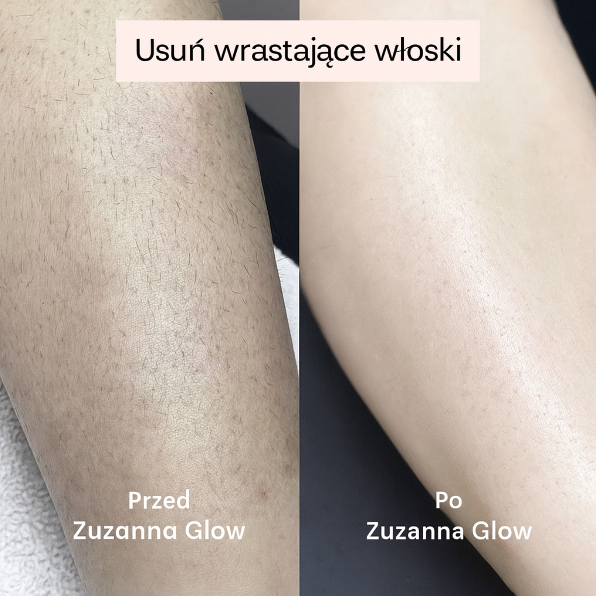 Zuzanna Glow Trymer 2w1