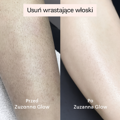 Zuzanna Glow Trymer 2w1