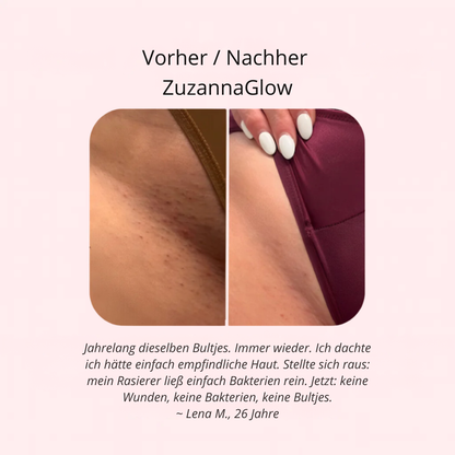 Zuzanna Glow 2-in-1 Trimmer | Antibakteriell & Schnittfrei