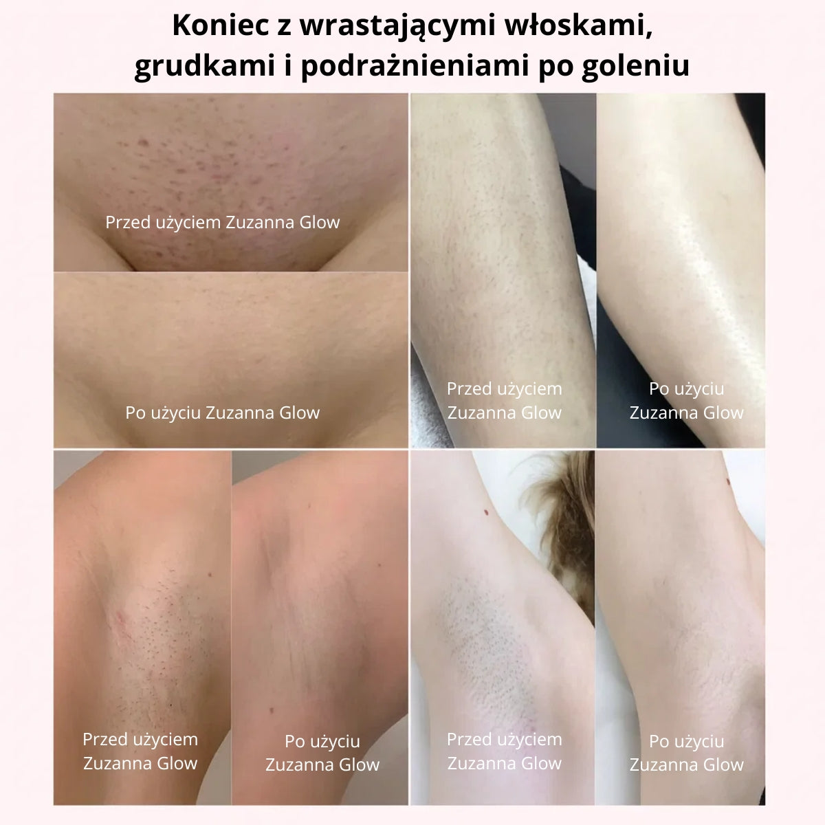 Zuzanna Glow Trymer 2w1