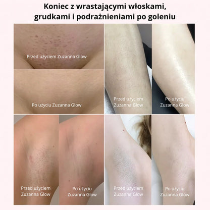 Zuzanna Glow Trymer 2w1